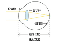Vol.6 近視?遠(yuǎn)視?散光?老花